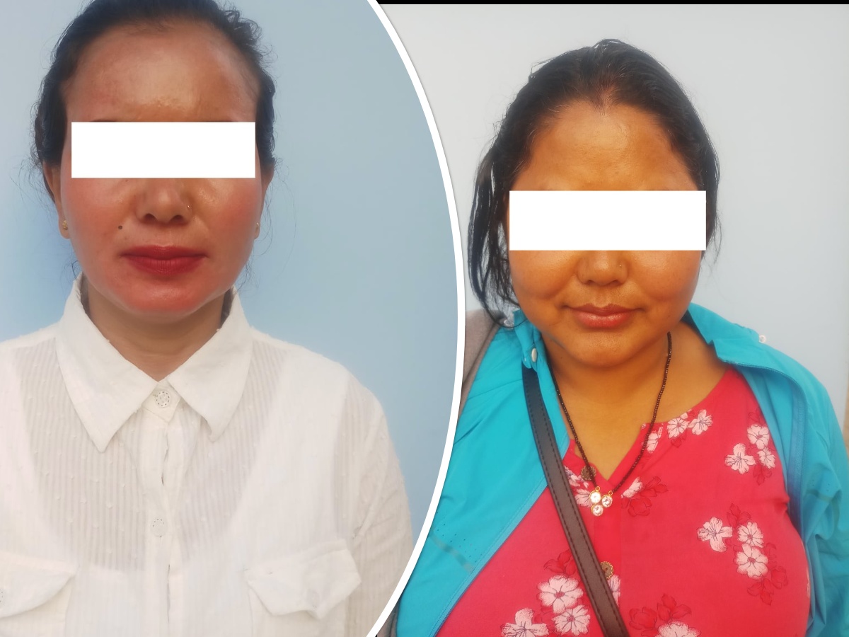 सुन्धाराको होटलमा हनी ट्र्यापमा फसे पुरुष : ब्ल्याकमेलिङ गर्ने दुई महिला पक्राउ 