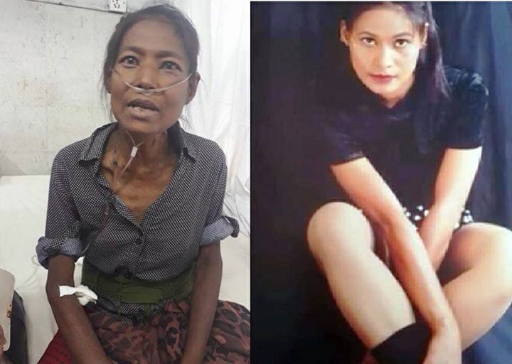 कलाकार लक्ष्मी रानाको निधन 
