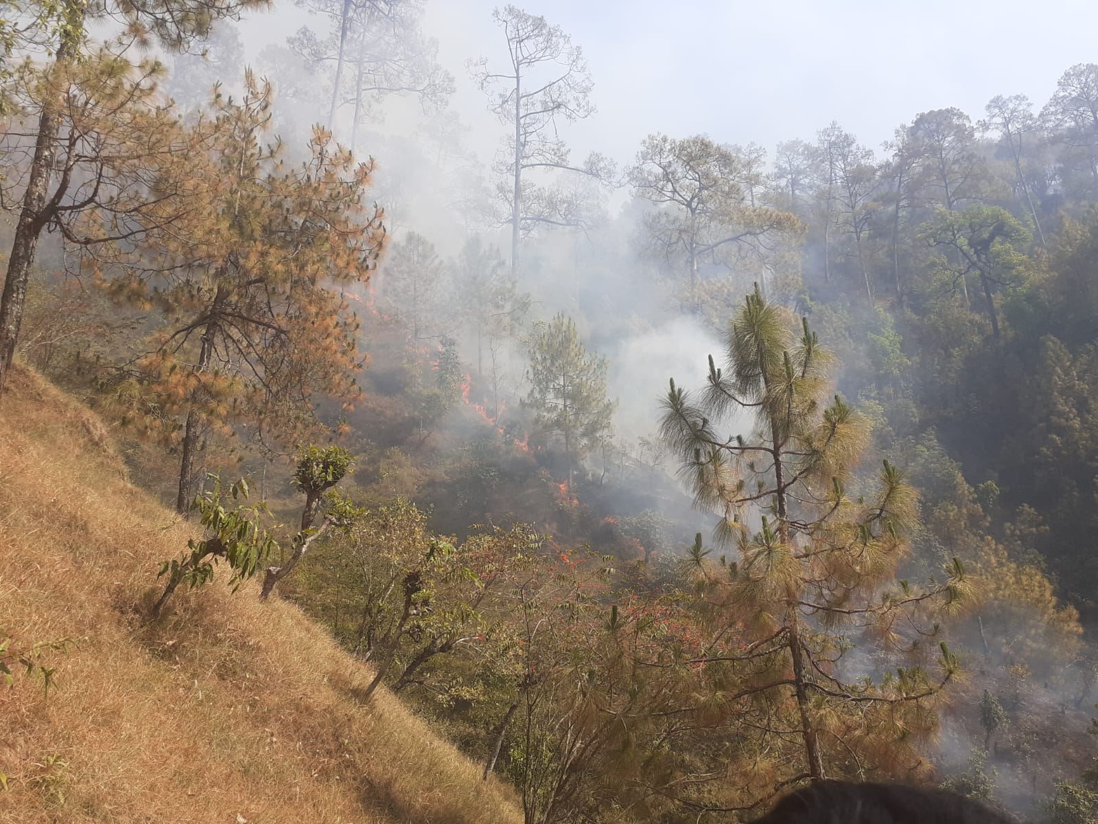 जंगलमा लागेको आगो निभाउन जाँदा गुल्मीमा एक जनाको मृत्यु, एक जना गम्भीर घाइते