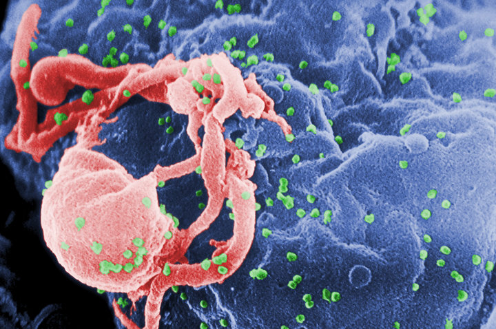 'लन्डन बिरामी': एचआईभी संक्रमित दोस्रो व्यक्ति रोगमुक्त!