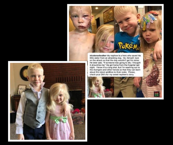 बहिनी बचाउन जर्मन सेफर्डसँग लड्ने बालकलाई 'सेलिब्रेटी सन्देश'