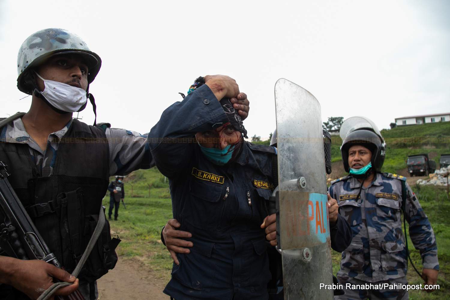 खोकनामा प्रहरी र स्थानीयबीच झडप : एक दर्जन अश्रुग्यास प्रहार, प्रहरीसहित स्थानीयवासी घाइते