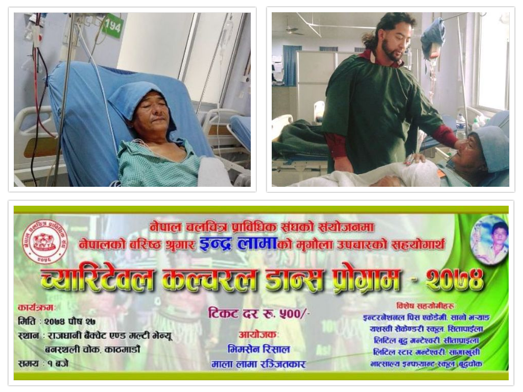 उपचारका लागि सहयोगको पर्खाइमा मेकअप आर्टिष्ट इन्द्र लामा, रकम जुटाउन च्यारिटी गरिदै