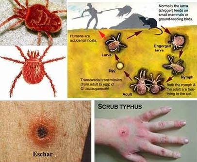 स्क्रब टाइफसबाट देशभरमा ३८५ संक्रमित, ९ जनाको मृत्यु